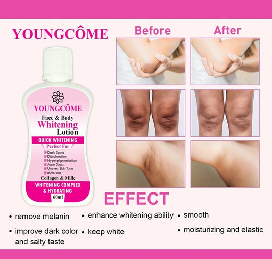 Youngcome Face Body Whitening